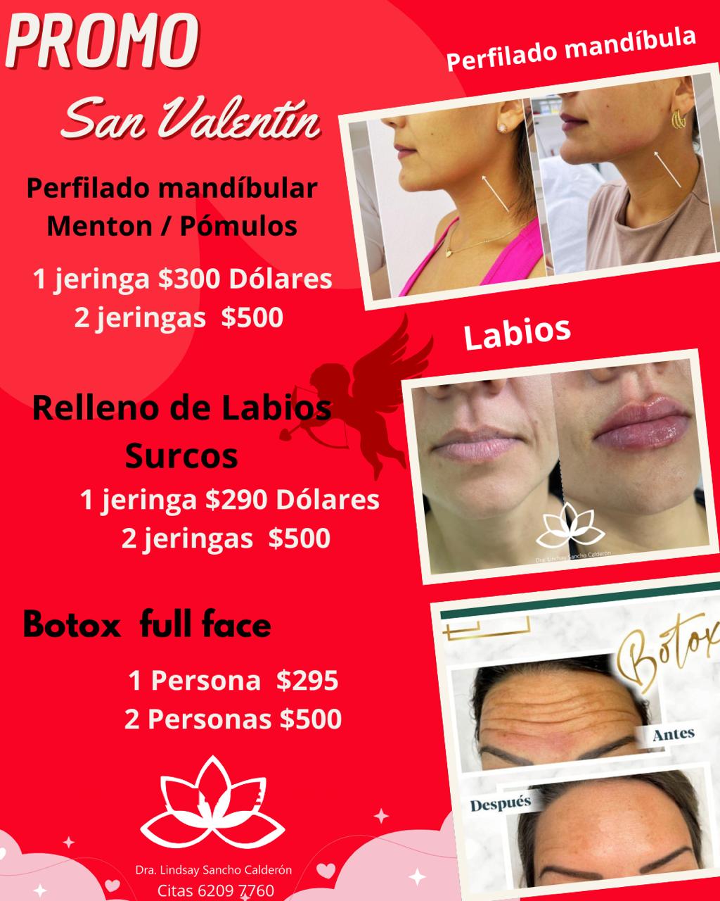 Promoción San Valentín